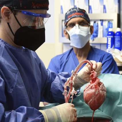 First-in-the-World Surgery: US Surgeon Transplanted Pig Heart into Human Patient