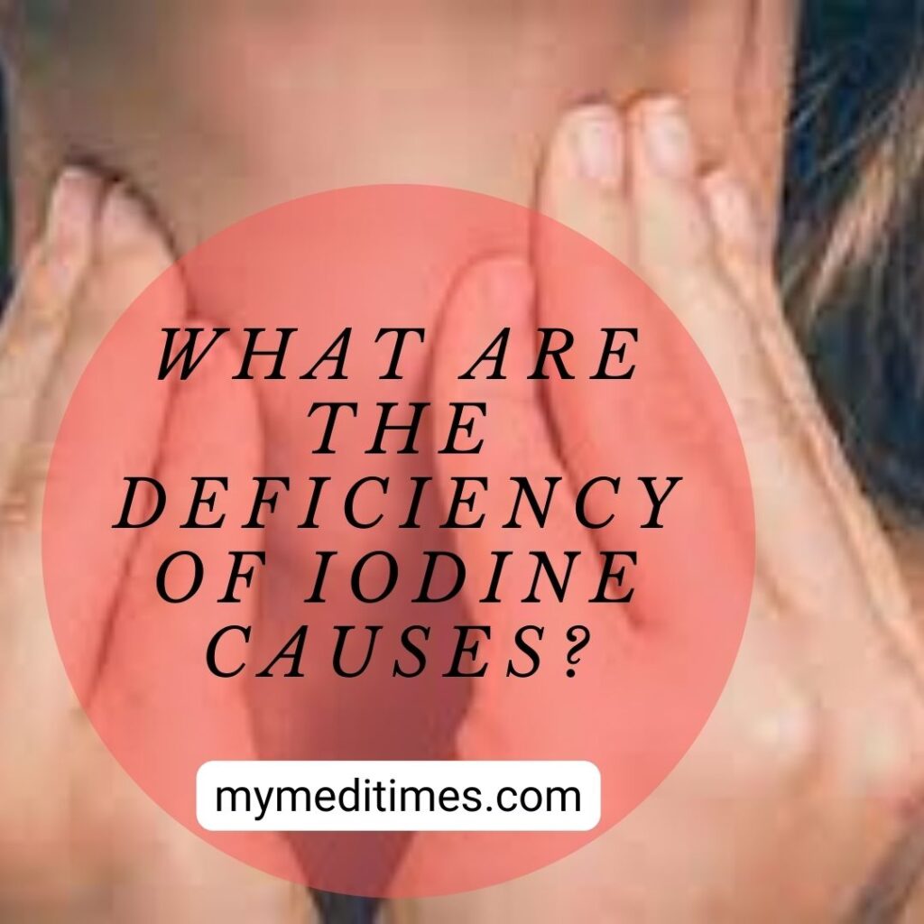 What Are the deficiency of iodine causes? My Medi Times