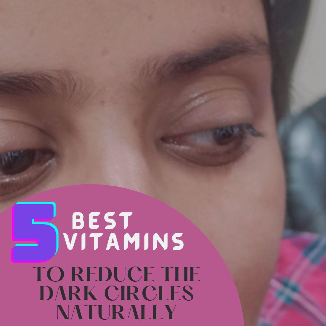 5 best vitamins to reduce the dark circles naturally