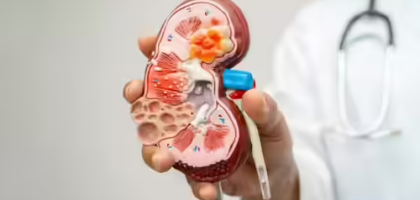 7 Everyday Habits That May Be Damaging Your Kidneys Without You Realizing It