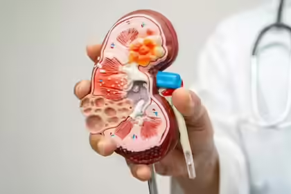 7 Everyday Habits That May Be Damaging Your Kidneys Without You Realizing It