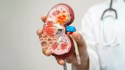 7 Everyday Habits That May Be Damaging Your Kidneys Without You Realizing It