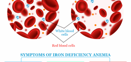 Iron Deficiency: Common Symptoms, Causes, Foods, and Prevention