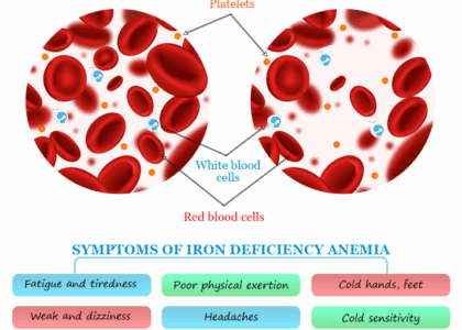 Iron Deficiency: Common Symptoms, Causes, Foods, and Prevention