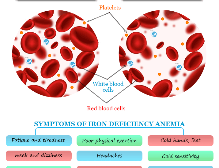 Iron Deficiency: Common Symptoms, Causes, Foods, and Prevention