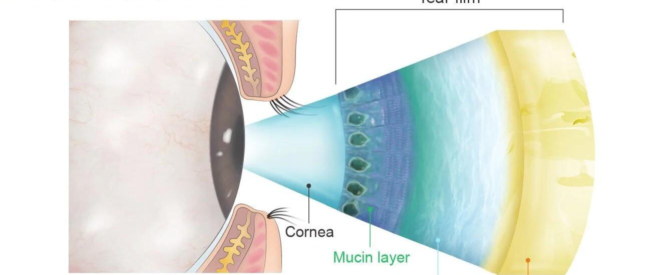 Why Do Your Eyes Water When They’re Actually Dry? Understanding Reflex Tearing